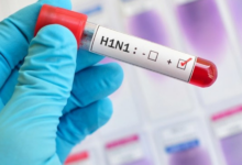 H1N1 يضرب والأطباء: لا داعي للهلع