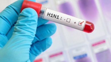 H1N1 يضرب والأطباء: لا داعي للهلع